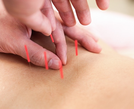 一人ひとりにあわせたオーダーメイド施術